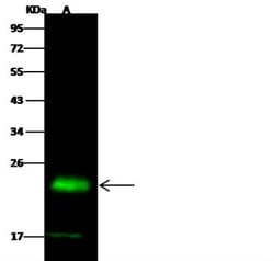 PMVK/phosphomevalonate kinase Rabbit anti-Human, Clone: 14, Novus Biologicals