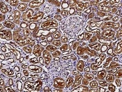 PMVK/phosphomevalonate kinase Antibody, Novus Biologicals 100 &mu;g; Unconjugated:Antibodies,