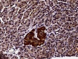 PMVK/phosphomevalonate kinase Antibody, Novus Biologicals 100 &mu;g; Unconjugated:Antibodies,