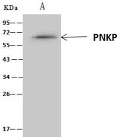 PNK Antibody, Novus Biologicals 100 &mu;g; Unconjugated:Antibodies, Polyclonal
