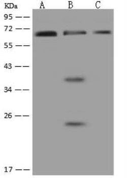 PNK Antibody, Novus Biologicals 100 &mu;g; Unconjugated:Antibodies, Polyclonal