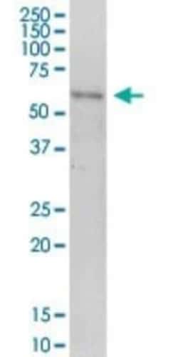 PNKD Antibody, Novus Biologicals 0.05 mg; Unconjugated:Antibodies, Polyclonal