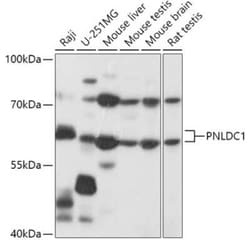 PNLDC1 Antibody - Azide and BSA Free, Novus Biologicals 0.02 mL; Unconjugated:Antibodies,