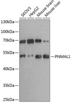 PNMA-like 1 Antibody - BSA Free, Novus Biologicals 0.02 mL; Unconjugated:Antibodies,