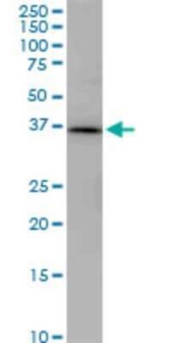 PNMA1 Antibody (1C3), Novus Biologicals 0.1 mg | Buy Online | Novus Biologicals | Fisher Scientific