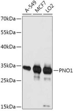 PNO1 Antibody - Azide and BSA Free, Novus Biologicals 0.1 mL; Unconjugated:Antibodies,