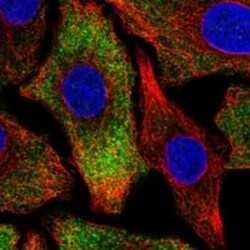 PNPLA6 Rabbit anti-Human, Polyclonal, Novus Biologicals 25 &mu;g; Unconjugated:Antibodies,