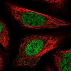 PNPO Antibody, Novus Biologicals 25 &mu;L; Unconjugated:Antibodies, Polyclonal