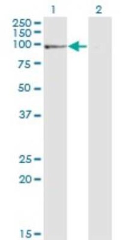Novus Biologicals PNUTS/PPP1R10 Antibody (1D6), Novus Biologicals 0.1 mg | Buy Online | Novus Biologicals&trade; | Fisher Scientific