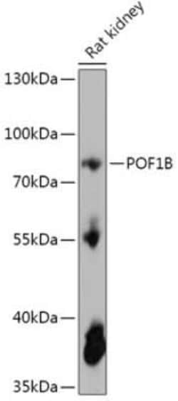 POF1B Antibody - Azide and BSA Free, Novus Biologicals 0.1 mL, Unconjugated:Antibodies,