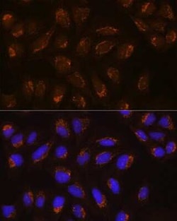 POFUT2 Antibody - Azide and BSA Free, Novus Biologicals 0.1 mL; Unconjugated:Antibodies,