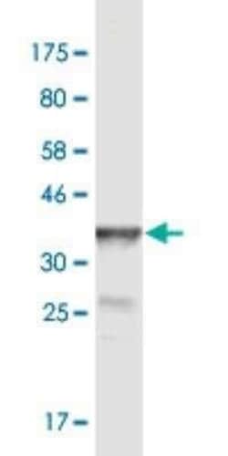 POGK Antibody (2D3), Novus Biologicals 0.1 mg | Buy Online | Novus Biologicals | Fisher Scientific