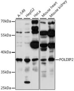 POLDIP2 Antibody - Azide and BSA Free, Novus Biologicals 0.02 mL; Unconjugated:Antibodies,