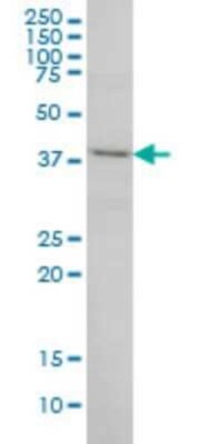 POLR1C Antibody (2E11), Novus Biologicals 0.1 mg | Buy Online | Novus Biologicals | Fisher Scientific