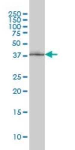 POLR1C Antibody (3A5-H2), Novus Biologicals 0.1 mg | Buy Online | Novus Biologicals | Fisher Scientific