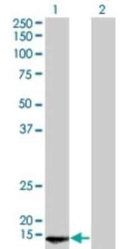 POLR2D Antibody (1E4-A5), Novus Biologicals 0.1 mg | Buy Online | Novus Biologicals | Fisher Scientific