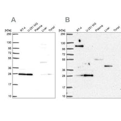 POLR2E Antibody, Novus Biologicals 0.1 mL, Unconjugated:Antibodies, Polyclonal