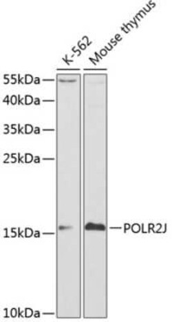 POLR2J Antibody - BSA Free, Novus Biologicals 0.1 mL; Unconjugated:Antibodies,