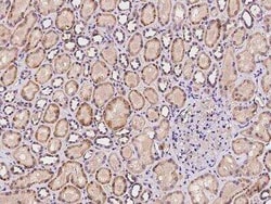 POLR3B Antibody, Novus Biologicals:Antibodies:Primary Antibodies