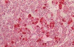 POMC Antibody, Novus Biologicals 50 &mu;g | Buy Online | Novus Biologicals | Fisher Scientific