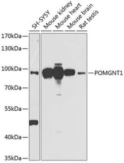 POMGNT1 Antibody - BSA Free, Novus Biologicals 0.1 mL; Unconjugated:Antibodies,