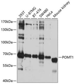 POMT1 Antibody - BSA Free, Novus Biologicals:Antibodies:Primary Antibodies