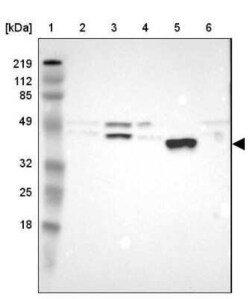 PON1 Antibody, Novus Biologicals:Antibodies:Primary Antibodies