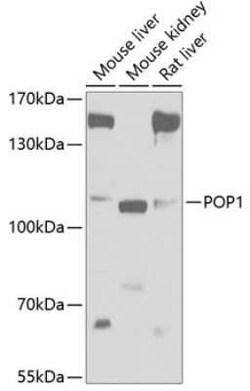 POP1 Antibody - BSA Free, Novus Biologicals 0.1 mL; Unconjugated:Antibodies,