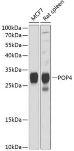 POP4 Antibody - BSA Free, Novus Biologicals 0.1 mL; Unconjugated:Antibodies,