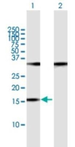 POP7 Antibody, Novus Biologicals 0.05 mg | Buy Online | Novus Biologicals | Fisher Scientific