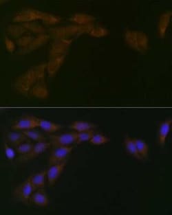 POR/Cytochrome P450 Reductase Rabbit anti-Human, Mouse, Rat, Clone: 9U1U7,