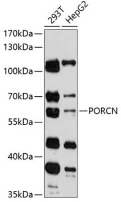 PORCN Antibody - Azide and BSA Free, Novus Biologicals 0.1 mL; Unconjugated:Antibodies,