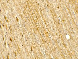POU2F3 Antibody - BSA Free, Novus Biologicals 0.1 mg; Unconjugated:Antibodies,