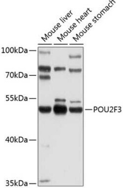 POU2F3 Antibody - BSA Free, Novus Biologicals 0.1 mL; Unconjugated:Antibodies,