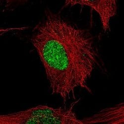 POU3F2/OCT7 Antibody (CL6228), Novus Biologicals 100&mu;L:Antibodies, Monoclonal
