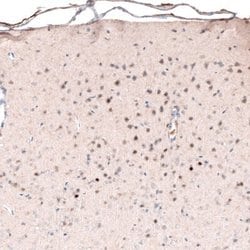 POU3F2/OCT7 Antibody (CL6228), Novus Biologicals 100&mu;L:Antibodies, Monoclonal
