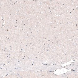 POU3F2/OCT7 Antibody (CL6228), Novus Biologicals 100&mu;L:Antibodies, Monoclonal