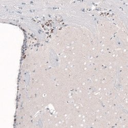 POU3F2/OCT7 Antibody (CL6228), Novus Biologicals 100&mu;L:Antibodies, Monoclonal