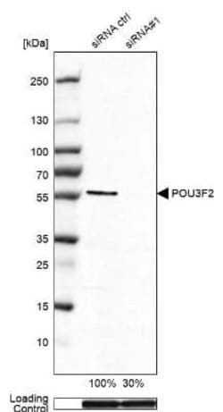 POU3F2/OCT7 Antibody (CL6228), Novus Biologicals 100&mu;L:Antibodies, Monoclonal