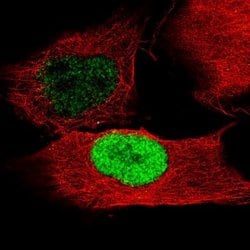 POU3F2/OCT7 Antibody (CL6232), Novus Biologicals:Antibodies:Primary Antibodies