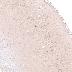 POU3F2/OCT7 Antibody (CL6232), Novus Biologicals:Antibodies:Primary Antibodies
