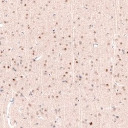 POU3F2/OCT7 Antibody (CL6232), Novus Biologicals:Antibodies:Primary Antibodies