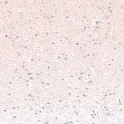 POU3F2/OCT7 Antibody (CL6232), Novus Biologicals:Antibodies:Primary Antibodies