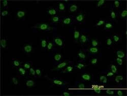 POU4F3 Antibody (5B8), Novus Biologicals 0.1 mg | Buy Online | Novus Biologicals | Fisher Scientific