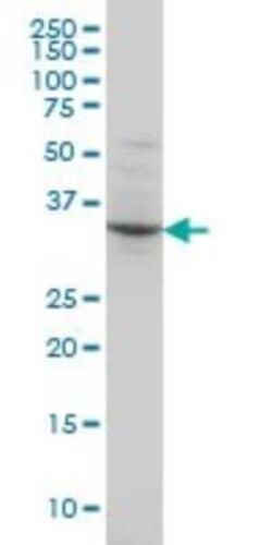 POU4F3 Antibody (5B8), Novus Biologicals 0.1 mg | Buy Online | Novus Biologicals | Fisher Scientific