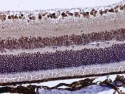 POU4F3 Antibody, Novus Biologicals 100 &mu;g | Buy Online | Novus Biologicals | Fisher Scientific