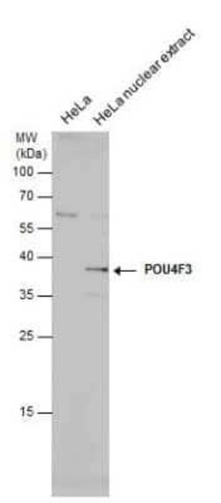 POU4F3 Antibody, Novus Biologicals 100 &mu;g | Buy Online | Novus Biologicals | Fisher Scientific