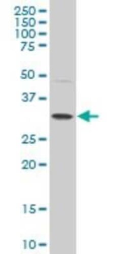 Novus Biologicals POU6F1 Antibody (5F9), Novus Biologicals 0.1 mg | Buy Online | Novus Biologicals&trade; | Fisher Scientific