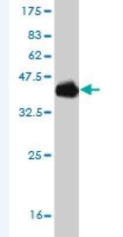 POU6F2 Antibody (8F9), Novus Biologicals 0.1 mg | Buy Online | Novus Biologicals | Fisher Scientific