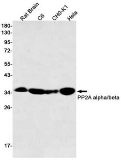 PP2A alpha/beta Rabbit anti-Human, Mouse, Rat, Clone: S04-4G4, Novus Biologicals 100 &mu;g | Buy Online | Novus Biologicals | Fisher Scientific